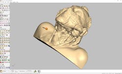 Machinedesign Com Sites Machinedesign com Files 3 D Result Of Neck Dissection