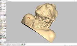 Machinedesign Com Sites Machinedesign com Files 3 D Result Of Neck Dissection Machinedesign Com Sites Machinedesign com Files 3 D Result Of Neck Dissection