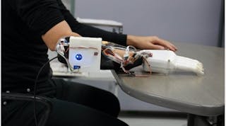 This prosthetic hand and socket uses AI, with the hand controlled by the Cybernetic Interface attached to the socket.