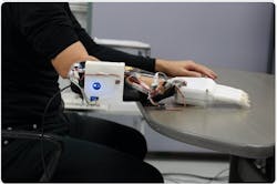 Prosthetic hand and socket Prosthetic hand and socket