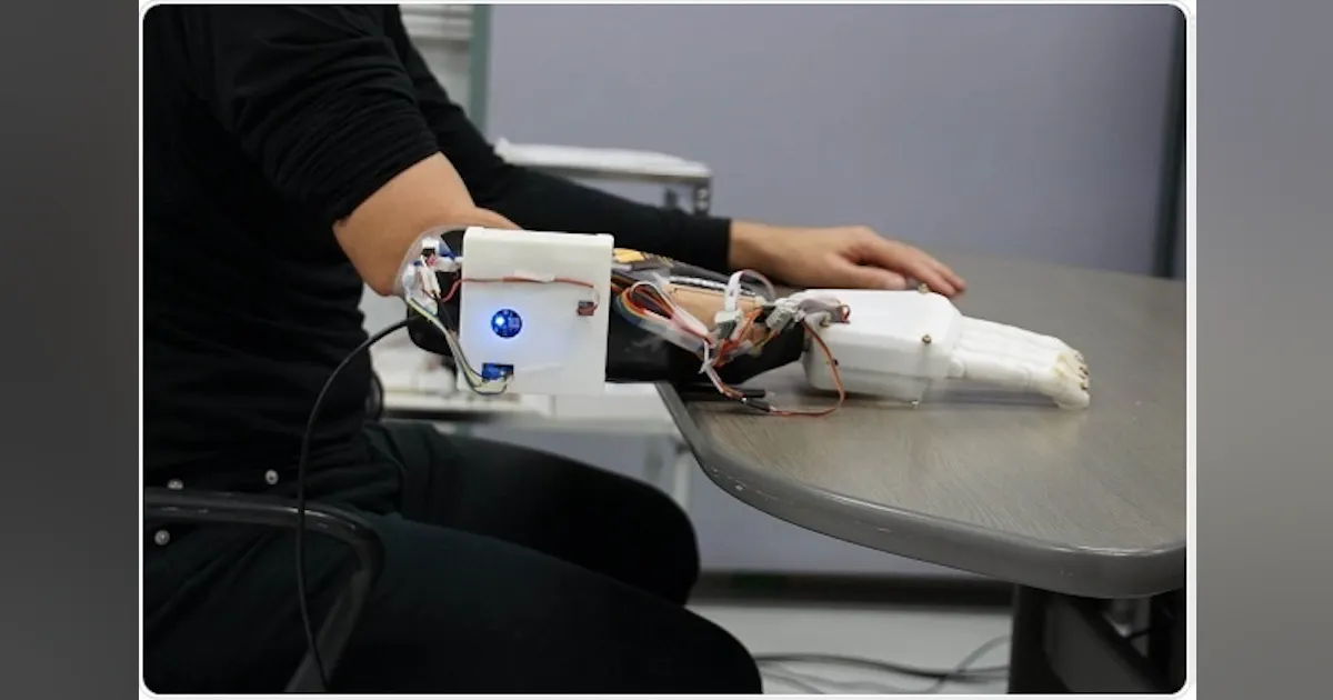 Hand Correct Prosthetic Hand Controlled by AI and Patient’s Thoughts | Machine Design
