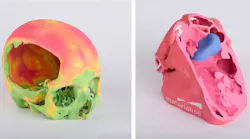 Skull model