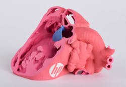 Machinedesign Com Sites Machinedesign com Files Congenital Heart 1 Machinedesign Com Sites Machinedesign com Files Congenital Heart 1