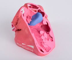 Machinedesign Com Sites Machinedesign com Files Congenital Heart 2 Machinedesign Com Sites Machinedesign com Files Congenital Heart 2