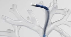 Machinedesign Com Sites Machinedesign com Files Fig 2 Promo Scoping Web Machinedesign Com Sites Machinedesign com Files Fig 2 Promo Scoping Web