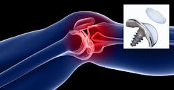 Knee pain and implant Knee pain and implant