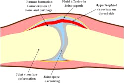 Machinedesign Com Sites Machinedesign com Files Ed Interest Arthritis Test Fig1 Machinedesign Com Sites Machinedesign com Files Ed Interest Arthritis Test Fig1