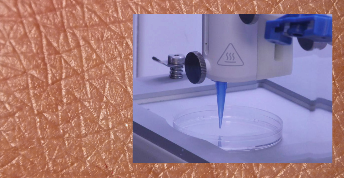 Bioprinting