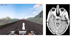 On the left is a screenshot of spatial memory task, while on the right an MRI scan shows where recording electrodes (black circles) were placed in a patient’s brain. On the left is a screenshot of spatial memory task, while on the right an MRI scan shows where recording electrodes (black circles) were placed in a patient’s brain.