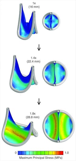 The scientists used computational modeling and FEA to predict how their valve replacement expanded to deal with the stress of blood flow. The scientists used computational modeling and FEA to predict how their valve replacement expanded to deal with the stress of blood flow.