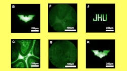 Imaging results Imaging results