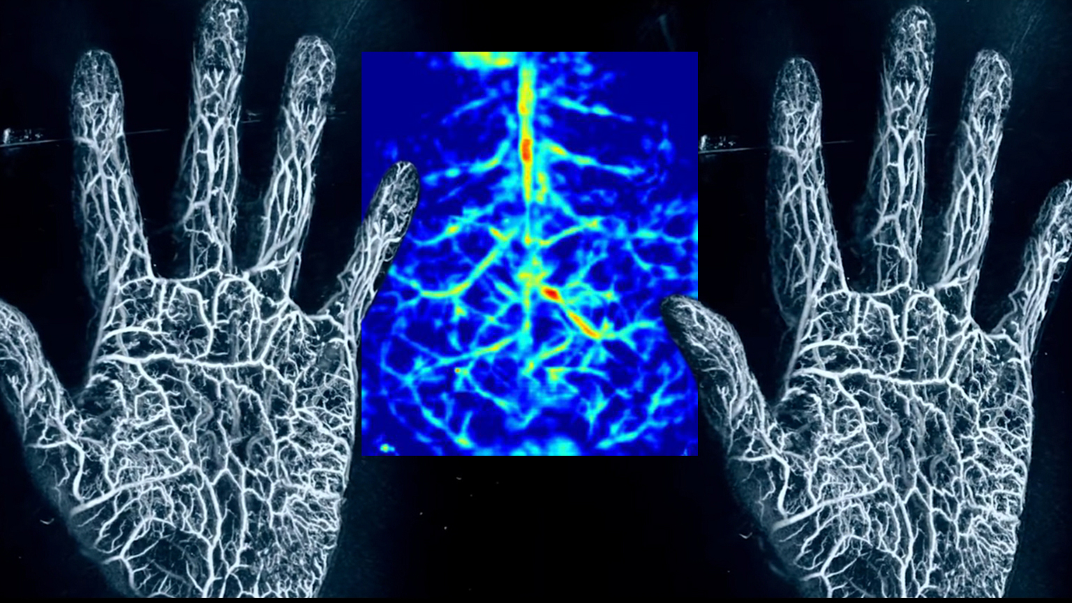 Photoacoustic Imaging Peering Inside the Body Using Lasers and