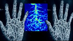 photoacoustic imaging photoacoustic imaging