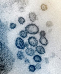 This transmission electron microscope image shows SARS-CoV-2, also known as 2019-nCoV, the virus that causes COVID-19. The spikes on the outer edge of the virus particles give coronaviruses their name, crown-like.