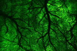 UC Berkeley researchers imaged neurons (green) in a large chunk of the cortex of the brain of a living mouse using a two-photon fluorescence microscope with an extra-large field of view. The image shows neurites in a volume of 4.2 mm &times; 4.2 mm x 100 microns. The dark branches are blood vessels.