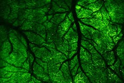 UC Berkeley researchers imaged neurons (green) in a large chunk of the cortex of the brain of a living mouse using a two-photon fluorescence microscope with an extra-large field of view. The image shows neurites in a volume of 4.2 mm × 4.2 mm x 100 microns. The dark branches are blood vessels. UC Berkeley researchers imaged neurons (green) in a large chunk of the cortex of the brain of a living mouse using a two-photon fluorescence microscope with an extra-large field of view. The image shows neurites in a volume of 4.2 mm × 4.2 mm x 100 microns. The dark branches are blood vessels.