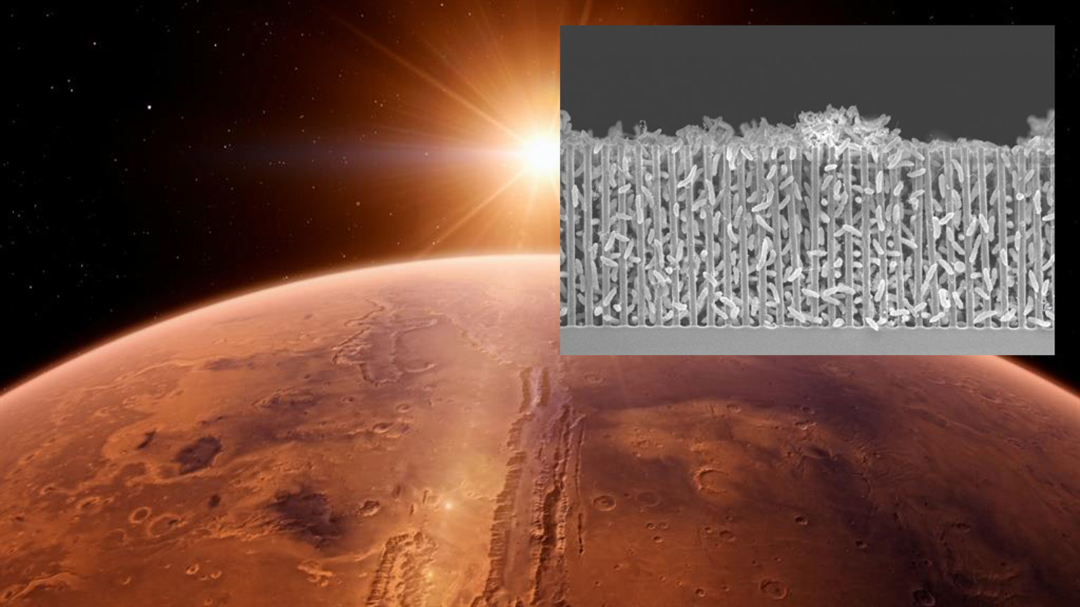 Scanning electron micrograph