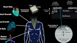 Medical sensor