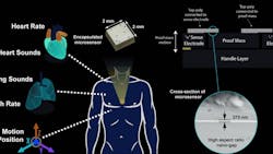 Medical sensor Medical sensor