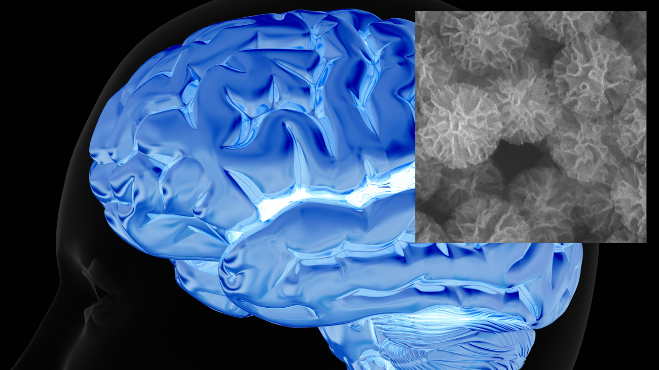 Brain and nanodevices