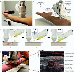 2. Robotic device set-up and operation: (a) Handheld venipuncture device. (b) Computer-aided design (CAD) displaying key components of the two-degree-of-freedom (DoF) device. Angle of insertion (θ) is fixed at 25 degrees. (c) Device operation: (i) Ultrasound (US) imaging plane provides a cross-sectional view of target vessel. (ii) Once a vessel is located by the device, the needle is aligned via the Z-axis motion (Zm) DoF motor; the Zm motor (blue arrow) is responsible for aligning the needle trajectory with the vessel depth (Z-axis) to ensure the needle tip reaches the vessel center exactly at the ultrasound imaging plane. (iii) Once trajectory is aligned, the needle is inserted via the injection motion (Inj m) DoF motor (green arrow) and automatically halted once the tip has reached the vessel center. (d) Device positioned over the upper forearm during the study. (e) Ultrasound image depicting the needle tip present in the target vessel after a successful venipuncture. Vessel wall is identified by a yellow dashed ellipse. The Z-axis in the image indicates the vessel depth and the Y-axis indicates the sagittal position of the vessel. Positions of the vessel and needle tip are recorded with respect to the ultrasound transducer head (top of image). 2. Robotic device set-up and operation: (a) Handheld venipuncture device. (b) Computer-aided design (CAD) displaying key components of the two-degree-of-freedom (DoF) device. Angle of insertion (θ) is fixed at 25 degrees. (c) Device operation: (i) Ultrasound (US) imaging plane provides a cross-sectional view of target vessel. (ii) Once a vessel is located by the device, the needle is aligned via the Z-axis motion (Zm) DoF motor; the Zm motor (blue arrow) is responsible for aligning the needle trajectory with the vessel depth (Z-axis) to ensure the needle tip reaches the vessel center exactly at the ultrasound imaging plane. (iii) Once trajectory is aligned, the needle is inserted via the injection motion (Inj m) DoF motor (green arrow) and automatically halted once the tip has reached the vessel center. (d) Device positioned over the upper forearm during the study. (e) Ultrasound image depicting the needle tip present in the target vessel after a successful venipuncture. Vessel wall is identified by a yellow dashed ellipse. The Z-axis in the image indicates the vessel depth and the Y-axis indicates the sagittal position of the vessel. Positions of the vessel and needle tip are recorded with respect to the ultrasound transducer head (top of image).