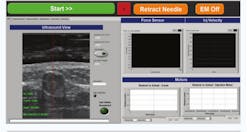 3. The major displays of the graphical user interface (GUI) for the handheld venipuncture device software include the ultrasound image stream, force sensor, injection motor velocity, and desired versus actual position for both Z-axis and injection motors. The red line in the ultrasound image is the needle trajectory. This is where the needle will intersect the ultrasound imaging plane. The user is tasked with manually placing the device such that the imaged vessel (dark ellipse) is centered with the needle trajectory line. 3. The major displays of the graphical user interface (GUI) for the handheld venipuncture device software include the ultrasound image stream, force sensor, injection motor velocity, and desired versus actual position for both Z-axis and injection motors. The red line in the ultrasound image is the needle trajectory. This is where the needle will intersect the ultrasound imaging plane. The user is tasked with manually placing the device such that the imaged vessel (dark ellipse) is centered with the needle trajectory line.