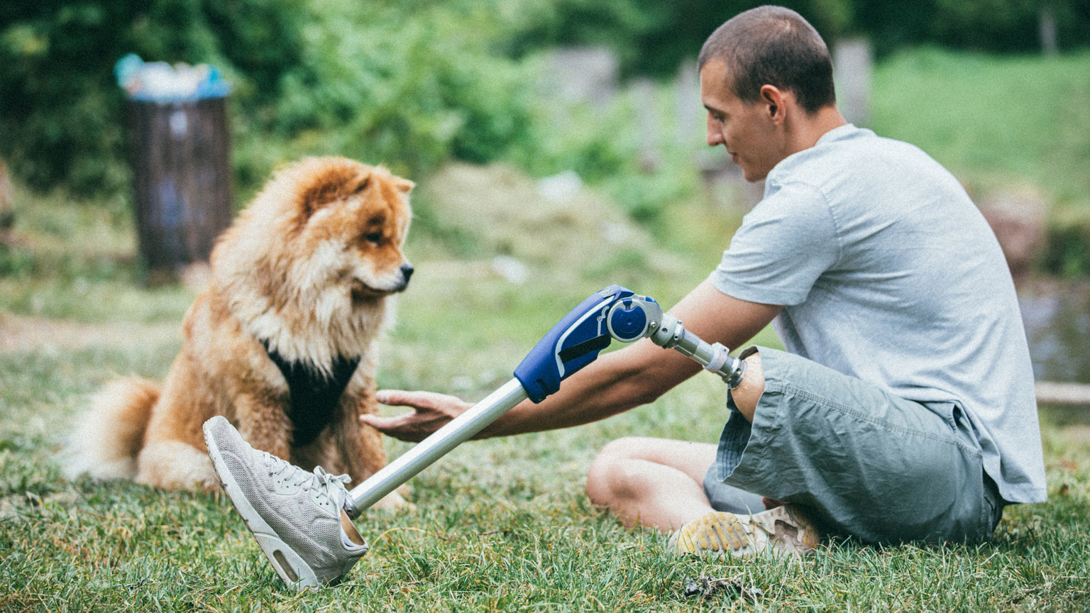 Man with prosthetic leg