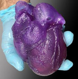 A 3D bioprinted heart model developed by Adam Feinberg and his team. A 3D bioprinted heart model developed by Adam Feinberg and his team.