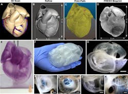 A 3D bioprinted heart model developed by Adam Feinberg and his team. A 3D bioprinted heart model developed by Adam Feinberg and his team.
