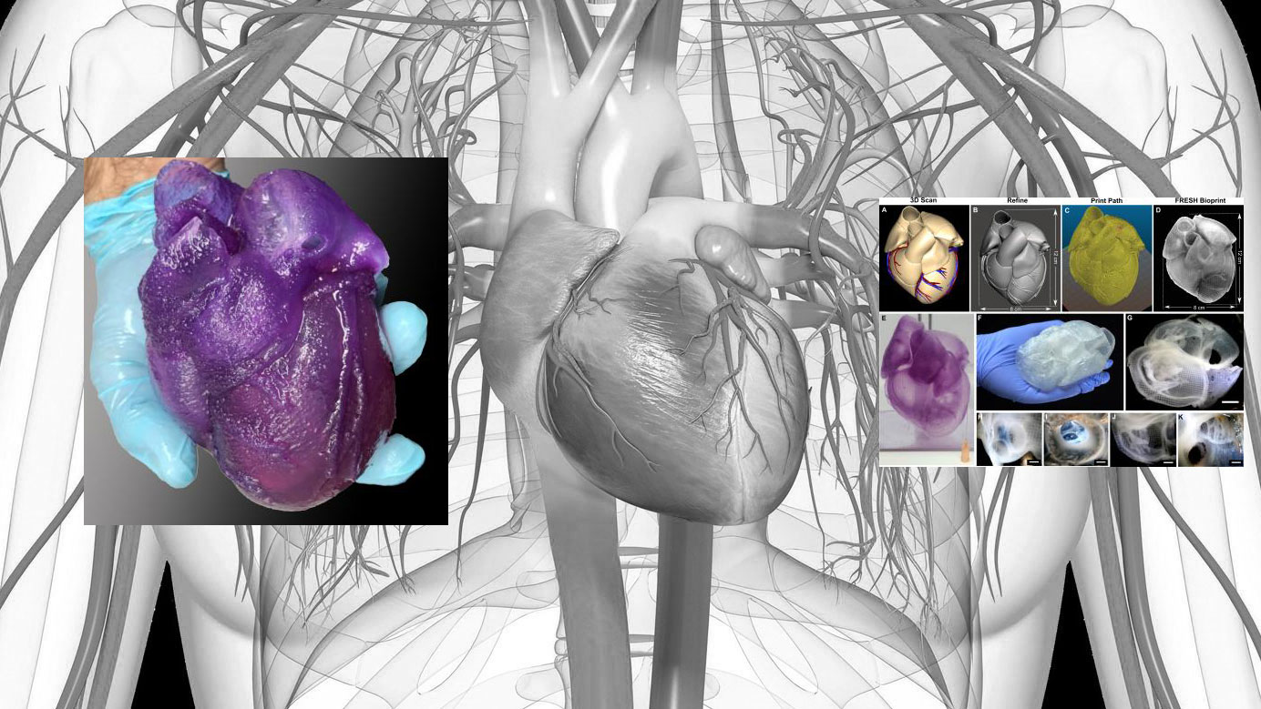 A FRESH Technique For Bioprinting Lifelike Heart Models | Machine Design