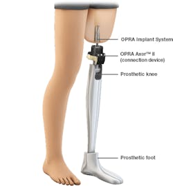 The lower leg prosthetic (knee, shin and foot) connects to the implanted titanium device.