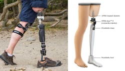 The new OPRA implant The new OPRA implant