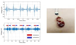 A small and inexpensive sensor, announced in Applied Physics Letters and based on an electrochemical system, could potentially be worn continuously by cardiac patients or others who require constant monitoring. Right: Wearable sensor attached to a patient’s chest. Top left: Heartbeat signal acquired from the sensor. Bottom left: Acquired breathing signal. A small and inexpensive sensor, announced in Applied Physics Letters and based on an electrochemical system, could potentially be worn continuously by cardiac patients or others who require constant monitoring. Right: Wearable sensor attached to a patient’s chest. Top left: Heartbeat signal acquired from the sensor. Bottom left: Acquired breathing signal.