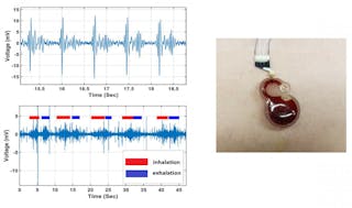 A small and inexpensive sensor, announced in Applied Physics Letters and based on an electrochemical system, could potentially be worn continuously by cardiac patients or others who require constant monitoring. Right: Wearable sensor attached to a patient&rsquo;s chest. Top left: Heartbeat signal acquired from the sensor. Bottom left: Acquired breathing signal.