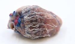 A fully printable biosensor made of soft bio-inks interfaces with a pig heart.
