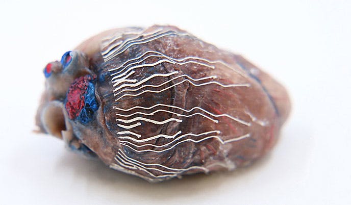 A fully printable biosensor made of soft bio-inks interfaces with a pig heart.