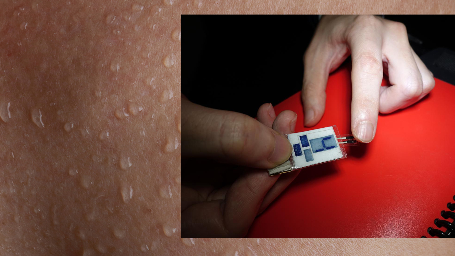 Hydrogel collecting sweat