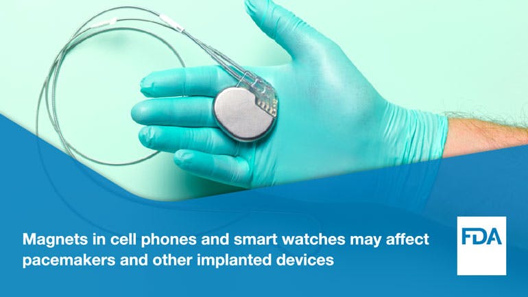 New research findings verify the FDA&apos;s recommendation for patients with implanted medical devices to keep their smartphones and watches at least 6 in. away to avoid interference with implanted medical devices.