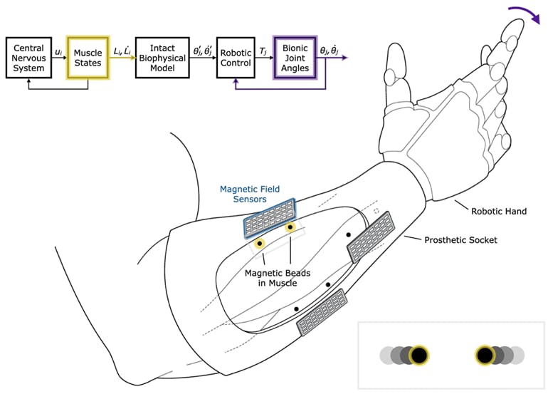 1. Free-space control of a robotic prosthesis via muscle magnetomicrometry: Passive magnetic beads (in yellow) implanted in muscle can be used to wirelessly track muscle length via an array of magnetic field sensors (blue) mounted to the outside of the body. The pair of magnetic beads highlighted here is placed in a single muscle, in line with the muscle fiber orientation. Muscle-length data can be streamed to a control unit, which in turn can be used to stream commands to neuroprosthetic devices such as exoskeletons, muscle stimulators, or the robotic hand shown here.