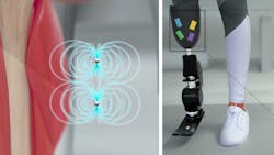 Prosthetic leg Prosthetic leg