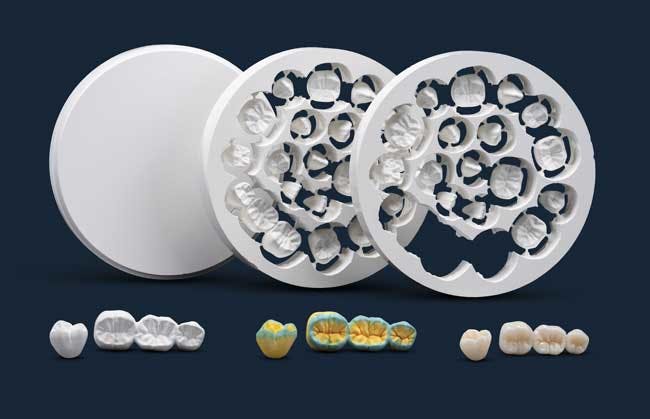 Every product that comes out of Glidewell&rsquo;s BruxZir factory is Lot Size 1: Blanks are selected based on patient-specific characteristics and milled according to custom projects.