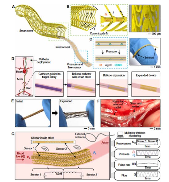 1. Overview of a fully implantable, wireless vascular electronic system with printed sensors for wireless monitoring of hemodynamics: (A) Illustration of the implantable electronic components. (B) Inductive stent design using conductive Au loops and nonconductive polyimide (PI) connectors to achieve a current path resembling a solenoid (left) and a scanning electron microscopy (SEM) image of the stent (right). (C) Layers of the soft pressure sensor using a printed dielectric layer (left) and photo of index finger holding a simultaneous flow and pressure sensor (right). AgNP, silver nanoparticle; PDMS, polydimethylsiloxane. (D) Illustration of minimally invasive catheter deployment and balloon expansion of the wireless vascular stent. (E) Initial and expanded state of the sensor-integrated stent system. (F) Wireless stent system implanted in the right iliac artery of living rabbit. (G) Illustration of the wireless design and sensing scheme to simultaneously monitor pressure, heart rate (HR) and flow.