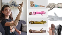 Prosthetic arm photo collage