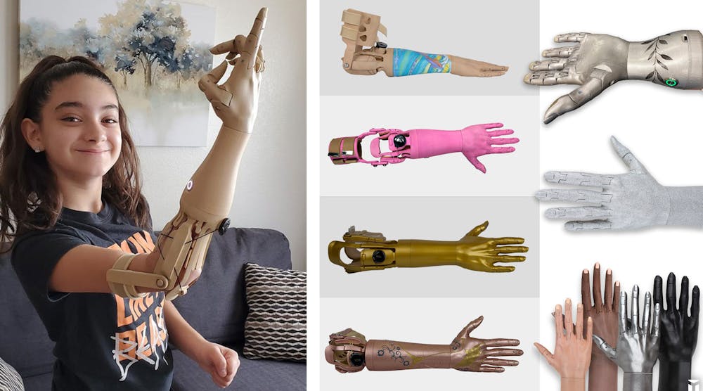Prosthetic arm photo collage