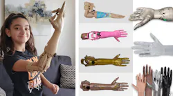 Prosthetic arm photo collage