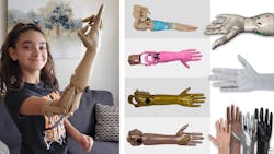 Prosthetic arm photo collage Prosthetic arm photo collage