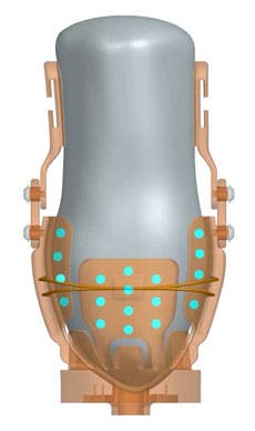 An array of 36 sensors is mounted in the socket detect changes in the underlying muscles shape. An array of 36 sensors is mounted in the socket detect changes in the underlying muscles shape.