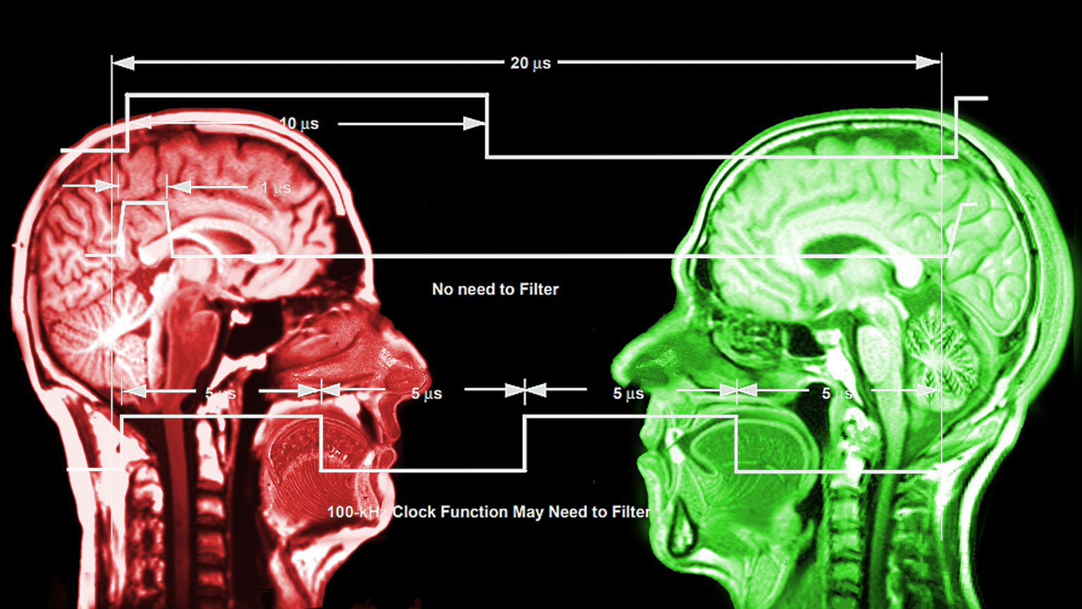 X-ray computed tomography