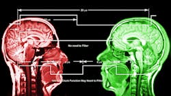 X-ray computed tomography X-ray computed tomography
