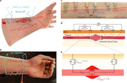 Ed Blood Pressure Tattoo Interest Fig1 62fe52104b69c Ed Blood Pressure Tattoo Interest Fig1 62fe52104b69c